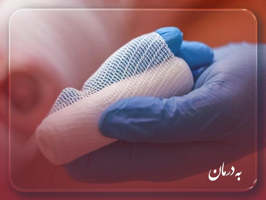 درمان زخم در منزل کرج