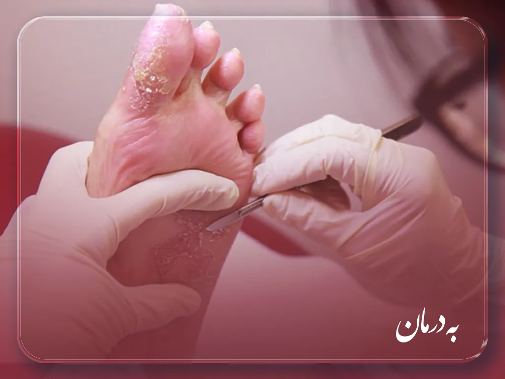 درمان زخم در منزل فردیس