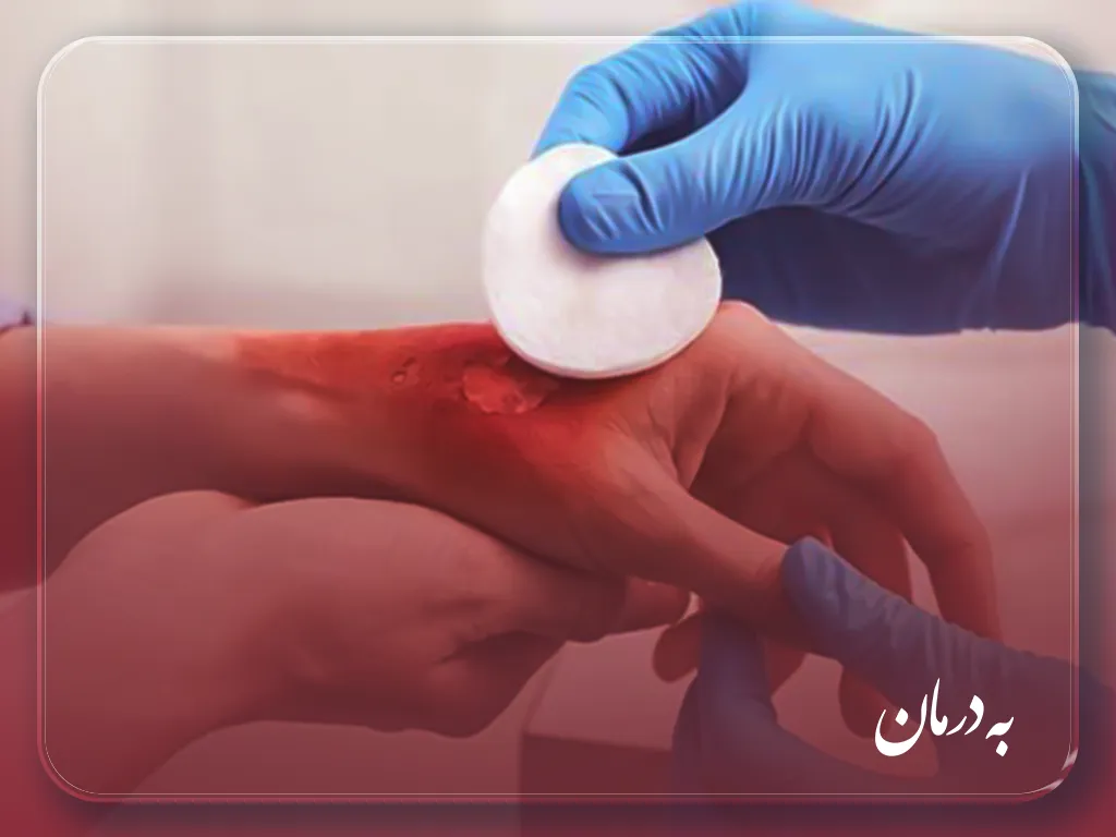 درمان زخم در منزل فردیس