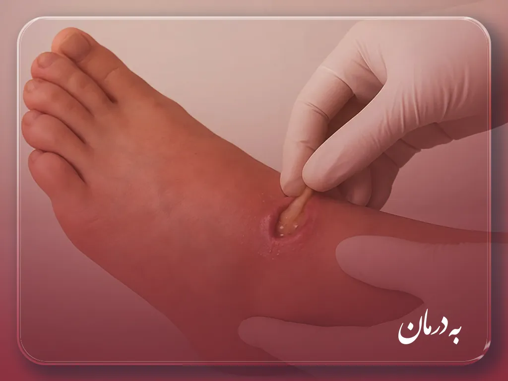 درمان زخم در منزل فردیس